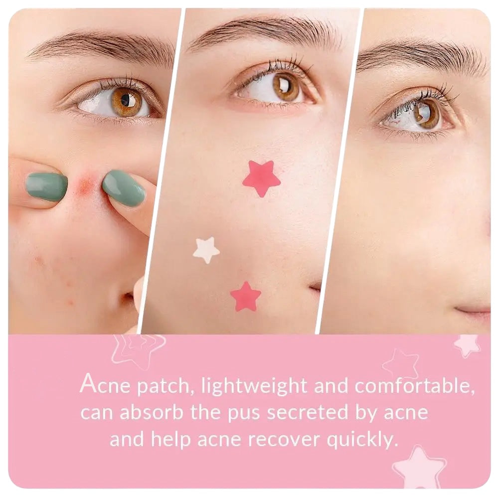 Star Acne Pimple Patch Acne Treatment Stickers